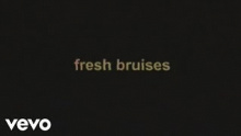 fresh bruises - Oliver Sykes